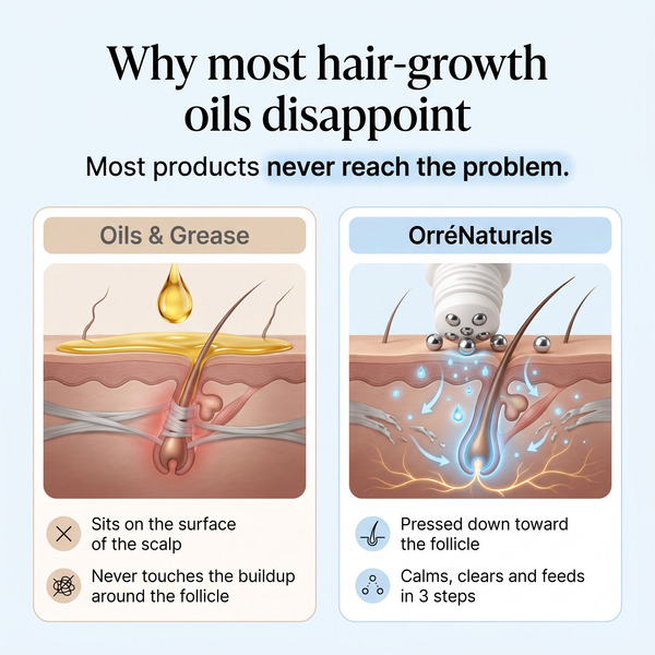OrréNaturals™ Hair Revival Ampoule (1.5 fl. oz)