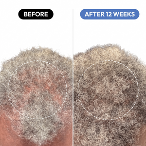 OrréNaturals™ Hair Revival Ampoule (1.5 fl. oz)