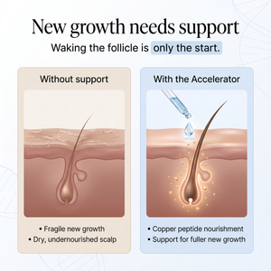 OrréNaturals™ Hair Growth Accelerator Serum