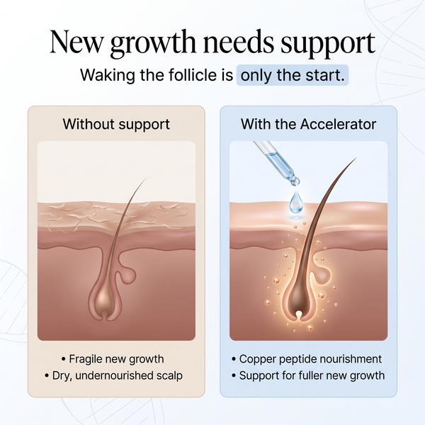 OrréNaturals™ Hair Growth Accelerator Serum